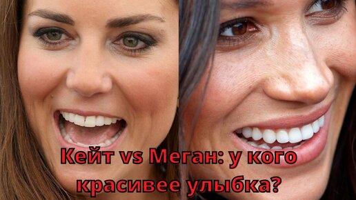 Кейт и Меган: у кого красивее улыбка? Красота от природы или дело рук стоматолога?