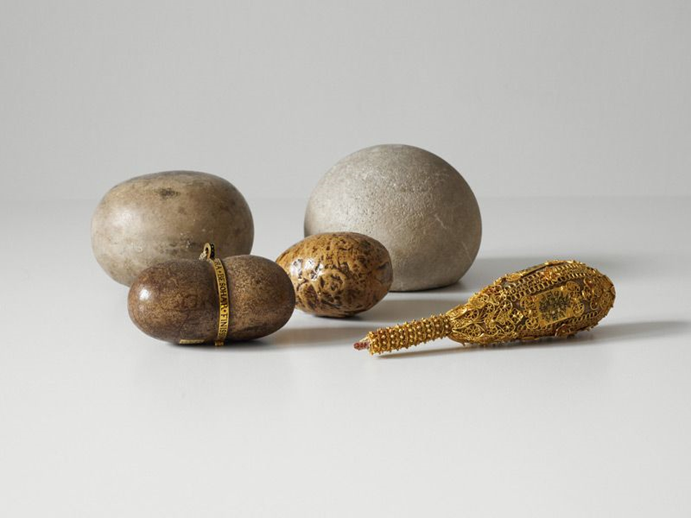 Желудочные камни безоар. Безоар камень. Безоаровый камень в желудке. Безоаровый камень в желудке. Безоар камень гарри поттер.