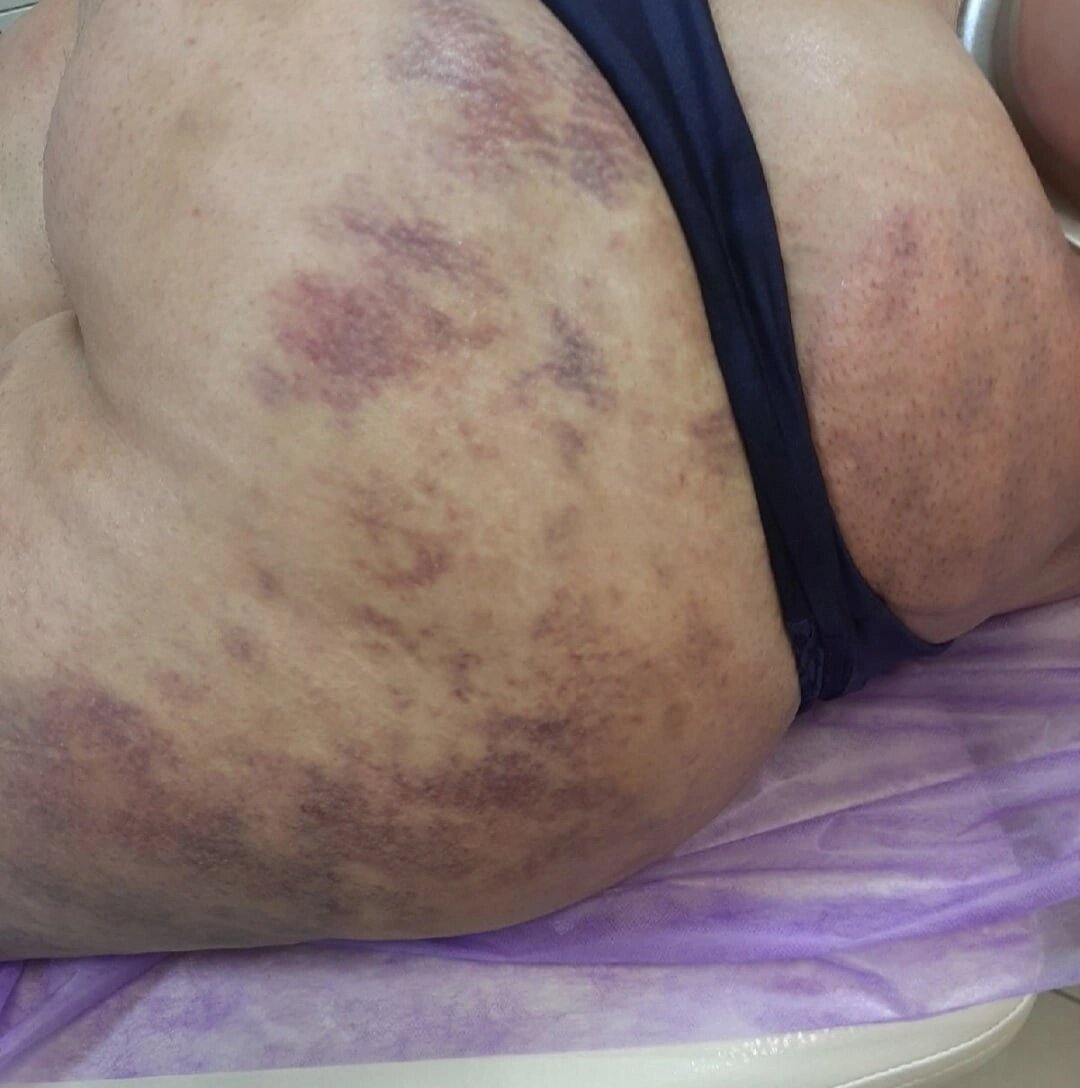 Как часто делают массажисты...