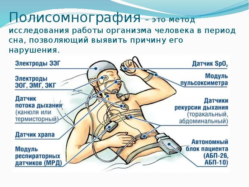 Врач по сну как называется. Методы исследования сна. Полисомнография. Полисомнографическое исследование. Полисомнографическое исследование сна.