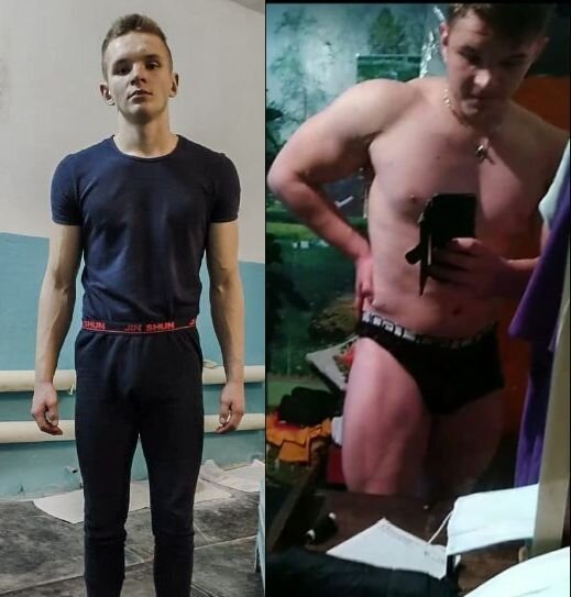 Алексей в 16 лет поднимает 100 кг на бицепс, но начал часто болеть. В чем проблема и что теперь делать.
