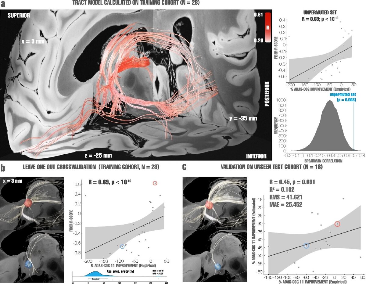    Поиски нужных точек для ввода электродовNature Communications (2022). DOI: 10.1038/s41467-022-34510-3