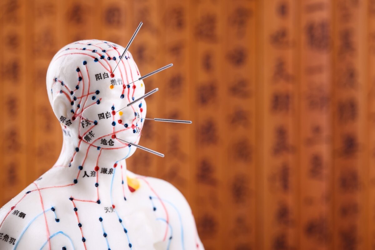 Acupuncture одежда. Традиционная китайская медицина акупунктура. Акупунктура иглоукалывание. Китайская медицина иглоукалывание.