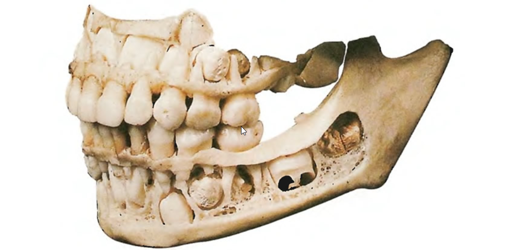 Анатомия челюсти молочных зубов. Строение челюсти ребенка. Че-еп ребенка с молочными зубами. Челоюсть смолочными зубами. Череп 5 лет