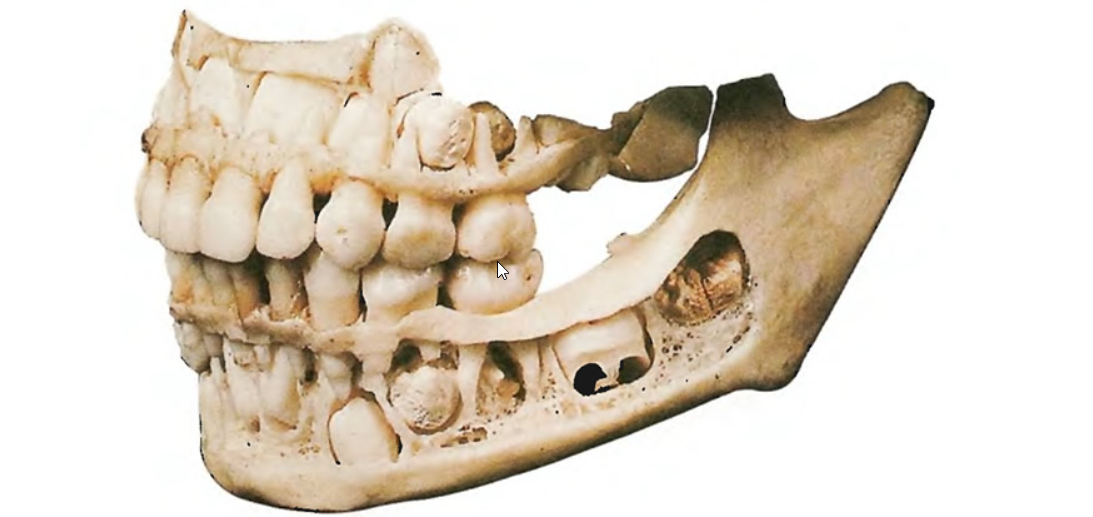 Череп маленьких людей. Анатомия челюсти молочных зубов. Строение челюсти ребенка. Че-еп ребенка с молочными зубами. Челоюсть смолочными зубами.