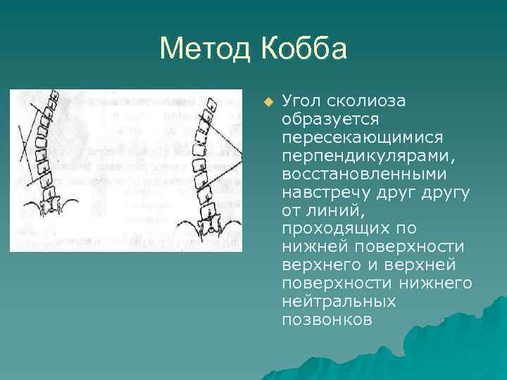 методика чтения снимкой