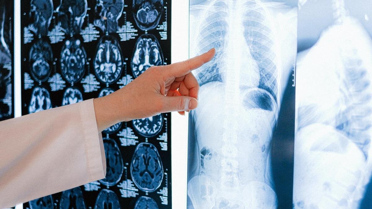    Врач показыват рукой на снимок грудной клетки:pexels.com