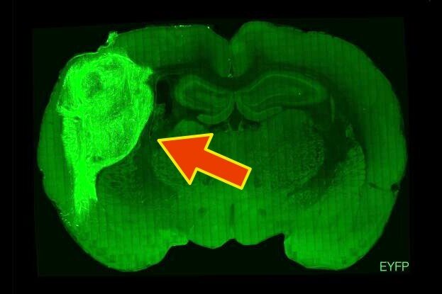     Ученые имплантировали фрагменты мозга человека в новорожденных крыс