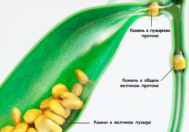 RU2317703C1 - Способ криоконсервирования спермы осетровых рыб - Google Patents