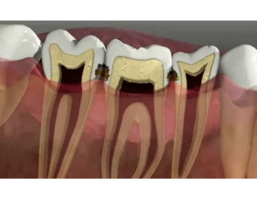 Схематический пример