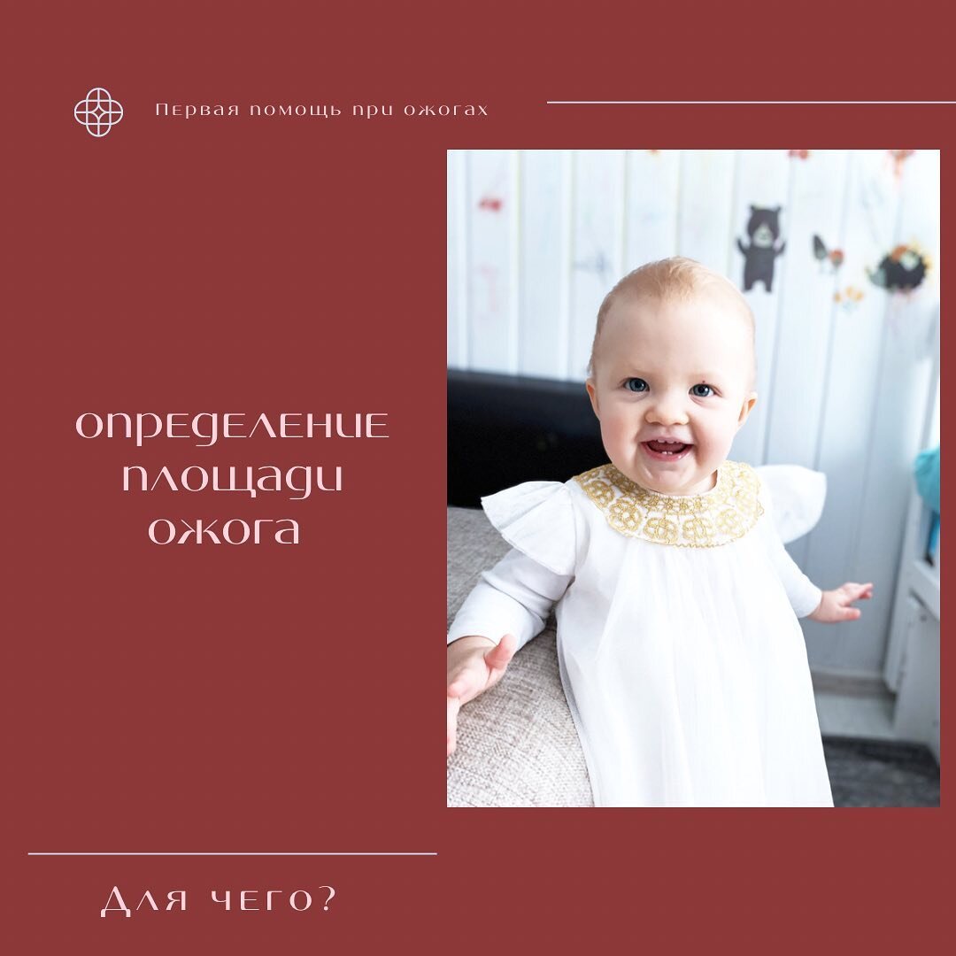 Определение площади ожога