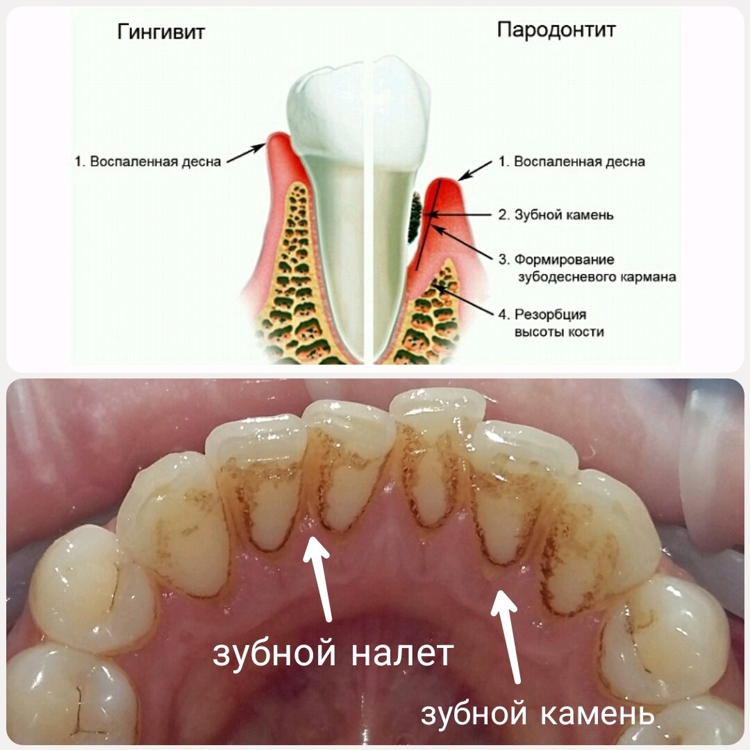 Проблемы с деснами? Ищите врача - пародонтолога?PerioStom- это единственный  пародонтологический центр России! | Центр лечения десен - PerioStom | Дзен