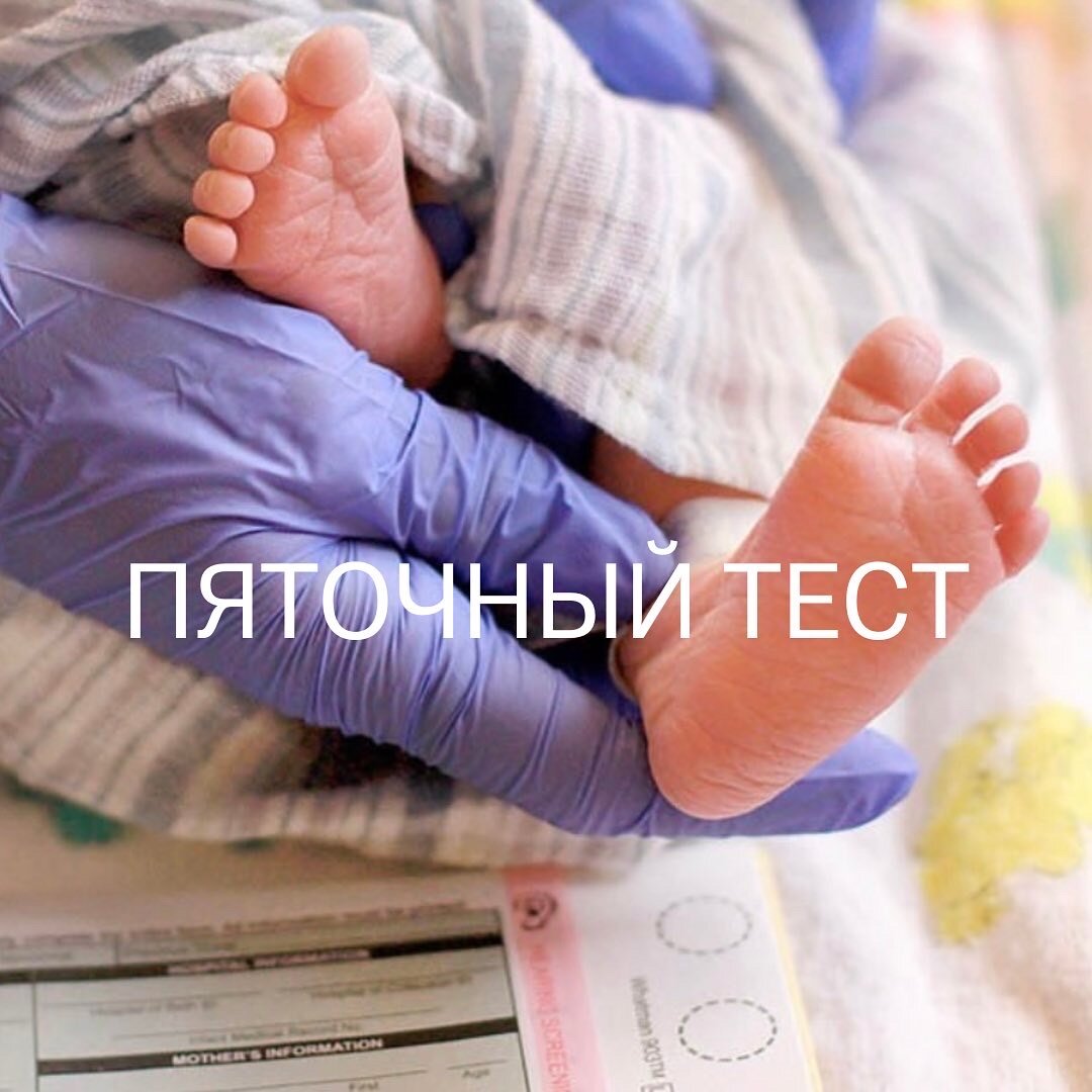 Большинству мам неонатальный скрининг известен под названием «пяточный тест» (или «кровь из пяточки»). Это метод диагностики врожденных генетических патологий, который позволяет выявить их на раннем этапе — до появления симптоматики.

В родильных домах Москвы с февраля 2020 года данный анализ проводится в расширенном формате: не на 5, а на 11 заболеваний. Например, таких как недостаточность биотинидазы, лейциноз и другие. Это значительно расширяет возможности их лечения.

Согласно протоколу, неонатальный скрининг осуществляется на 4-й день жизни, если ребенок родился доношенным, и на 7-е сутки, если не доношенным.

Процедура предельно проста: кровь малыша помещается на специально заготовленные промокательные бумажки и вместе с сопроводительным листом, где указаны все данные его и мамы, отправляется в лабораторию Морозовской детской клинической больницы. Там работают специалисты высокого уровня, начиная с генетиков и заканчивая эндокринологами и педиатрами. Они, проанализировав полученный материал, составляют ответ: есть ли у ребенка какие-то наследственные заболевания или нет. С родителями свяжутся только в случае положительного теста. Если никаких генетических патологий не выявлено, то история на этом заканчивается.

Действительно, в большинстве случаев, если ни со стороны матери, ни со стороны ребенка нет никаких отклонений в состоянии здоровья, осуществляется так называемая ранняя выписка из родильного дома — на 3-и сутки. Однако это не означает, что такой малыш будет лишен неонатального скрининга. На этот случай в роддоме предусмотрен другой протокол — передача на патронаж. Специальная детская медицинская сестра в обязательном порядке передает все данные о малыше (в том числе, что ему необходимо провести неонатальный скрининг) в поликлинику по месту жительства. Именно фактического пребывания, а не регистрации или постоянной прописки. (То есть, по тому адресу, который укажет мама при выписке, где она точно будет находиться с ребенком после роддома).

Таким образом, при первом посещении малыша на дому у него возьмет неонатальный скрининг патронажная медсестра.

Важно, чтобы ножка вашего малыша была теплой и увлажненной. Рекомендуем делать это во время кормления ребенка, чтобы обеспечить ребёнку комфорт.