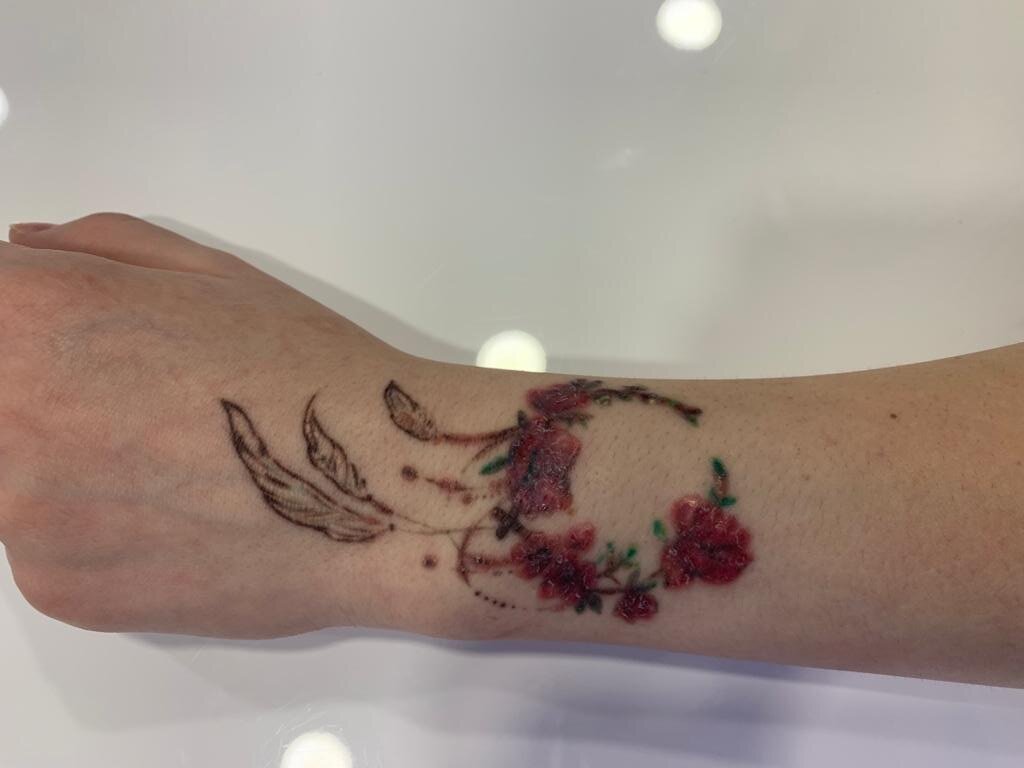 Аллергическая реакция на красные пигменты в татуировках