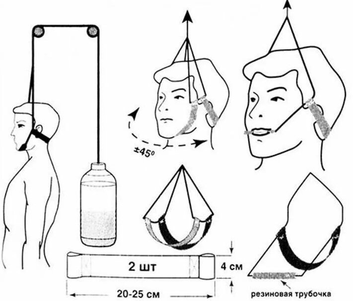 Как пользоваться головой. Вытяжение шейного отдела позвоночника петля Глиссона. Тренажер Атлант петля Глиссона. Растяжка шеи петля Глиссона. Вытяжка позвоночника петля Глиссона.