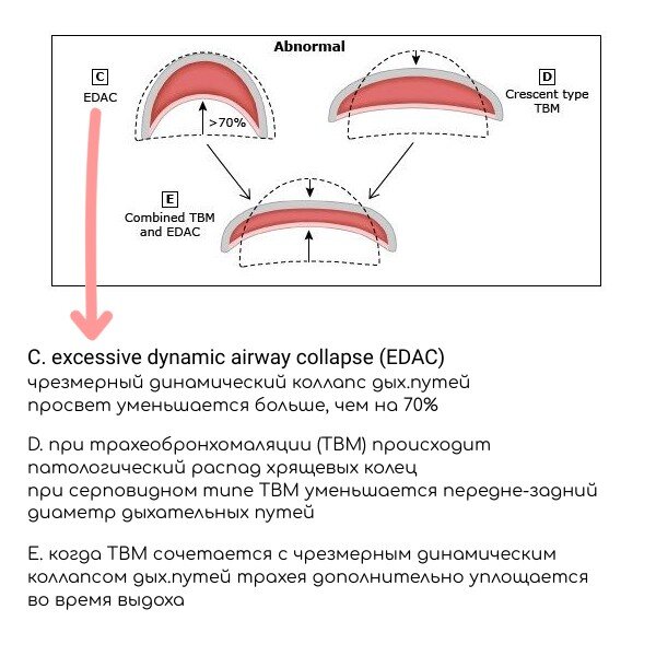 тест легких по пальцам. как проверить лёгкие. диагностика калининград. как самому проверить легкие. как проверить свои легкие в домашних условиях.