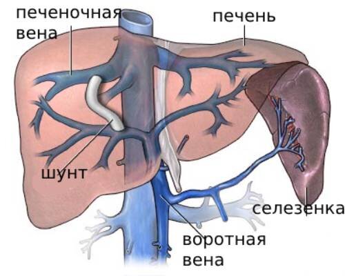 Диагностика и лечение хронических заболеваний печени