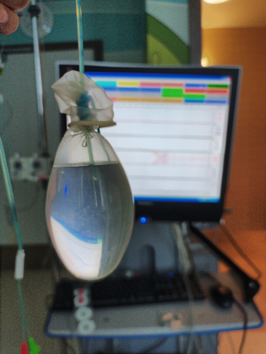 2 импровизированный мочевой пузырь.