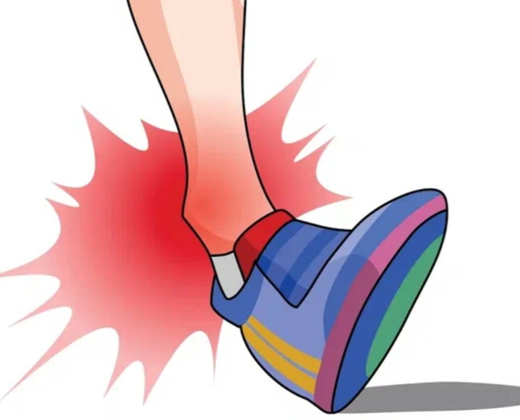 Пребольно подвернувшись... (Взято из Яндекс картинки) 