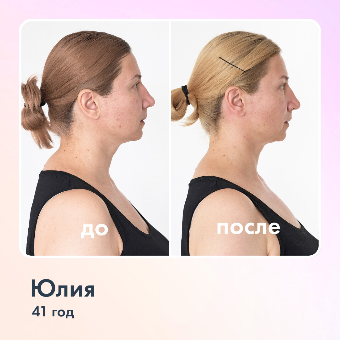 Фото сделаны и предоставлены пользователем Ревитоники