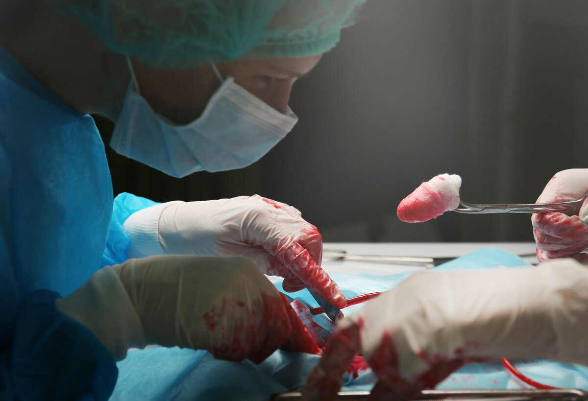 Костромские сердечно-сосудистые хирурги написали заявление об увольнении по собственному желанию 