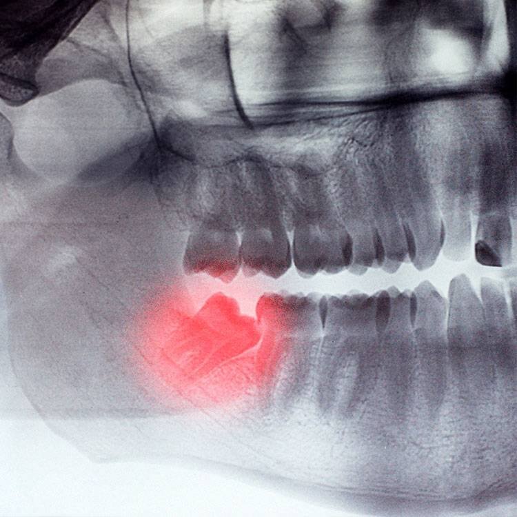 #здоровье #медицина