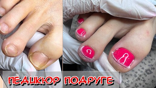 Педикюр подруге / Аппаратный педикюр / комбинированный педикюр #Nails #Ногти #педикюр