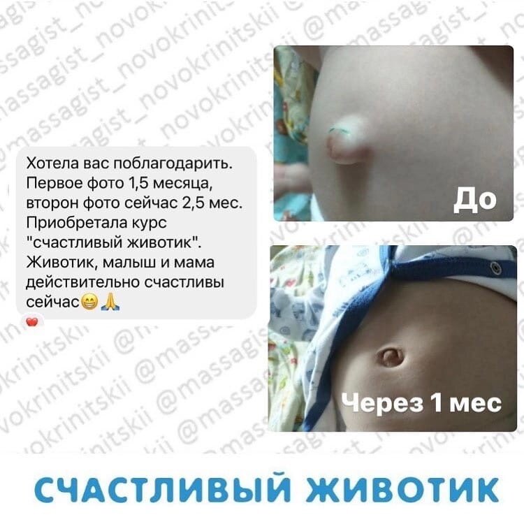 Хирургическое удаление грыжи