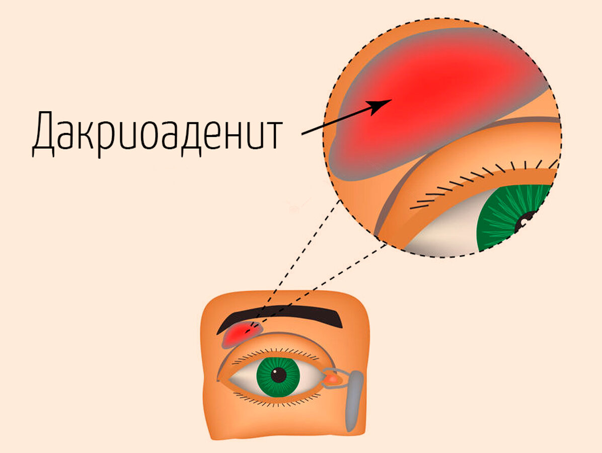 слезное озеро