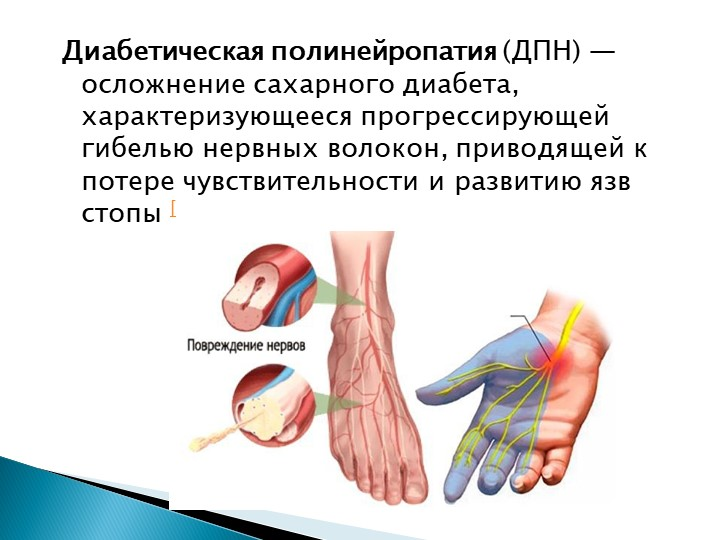 Нейропатия конечностей отзывы: найдено 82 картинок