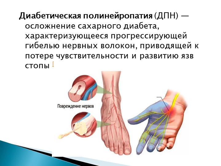 Полинейропатия осложнение сахарного диабета. Диабетическая полинейропатия 3 степени. Симптомы диабетической нейропатии конечностей. Диабетическая полинейропатия и алкогольная полинейропатия что это.