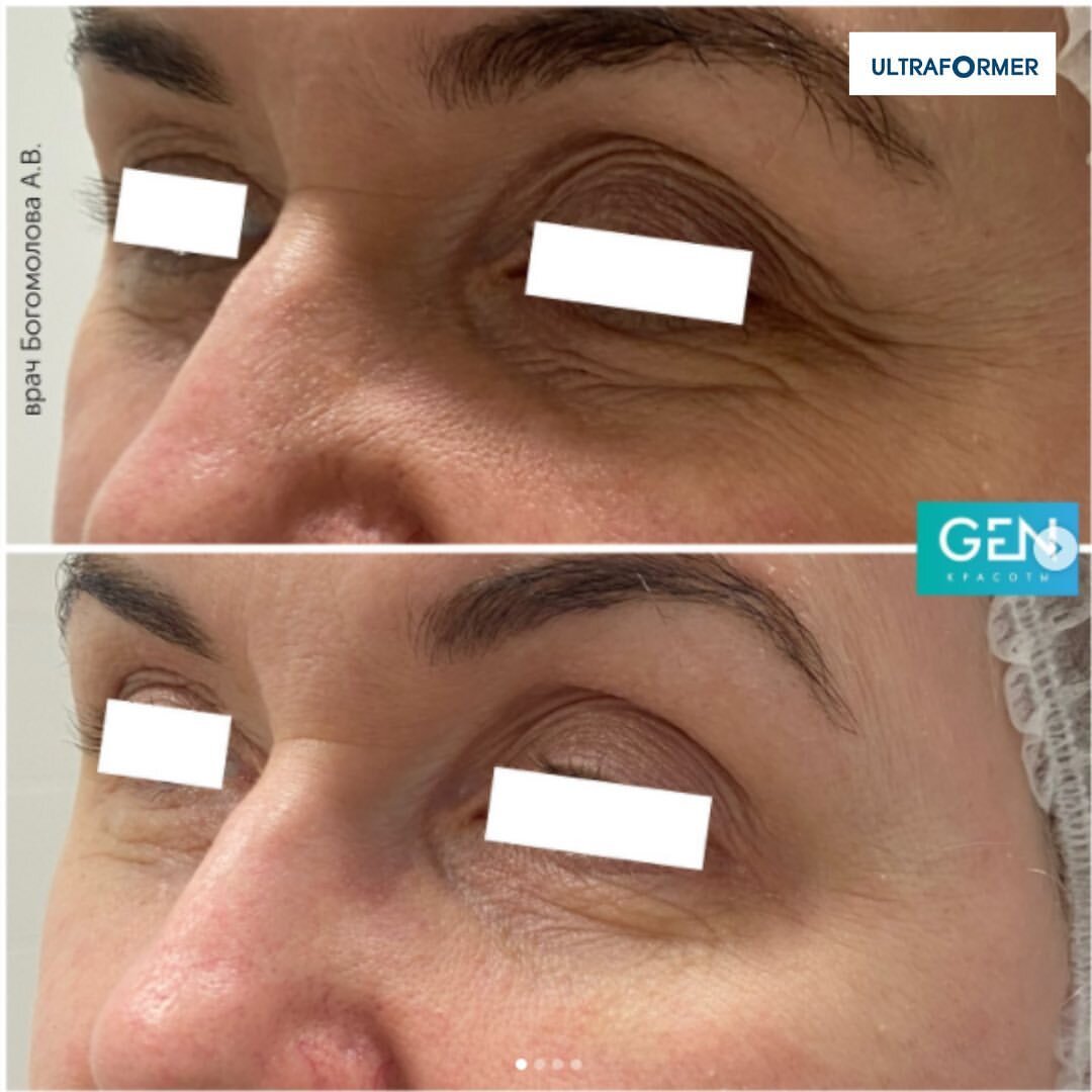 Клиника Ген красоты: https://gen-krasoty.ru