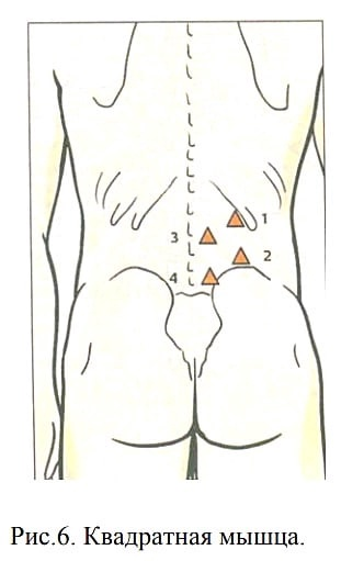 При заболеваниях определенных органов, в результате длительной болевой иннервации образуются триггерные точки в соответствующих зонах и сегментах данному органу.