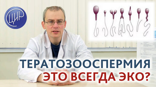 Тератозооспермия - это всегда ЭКО? Отвечает врач уролог-андролог ЦИР Живулько А.Р.