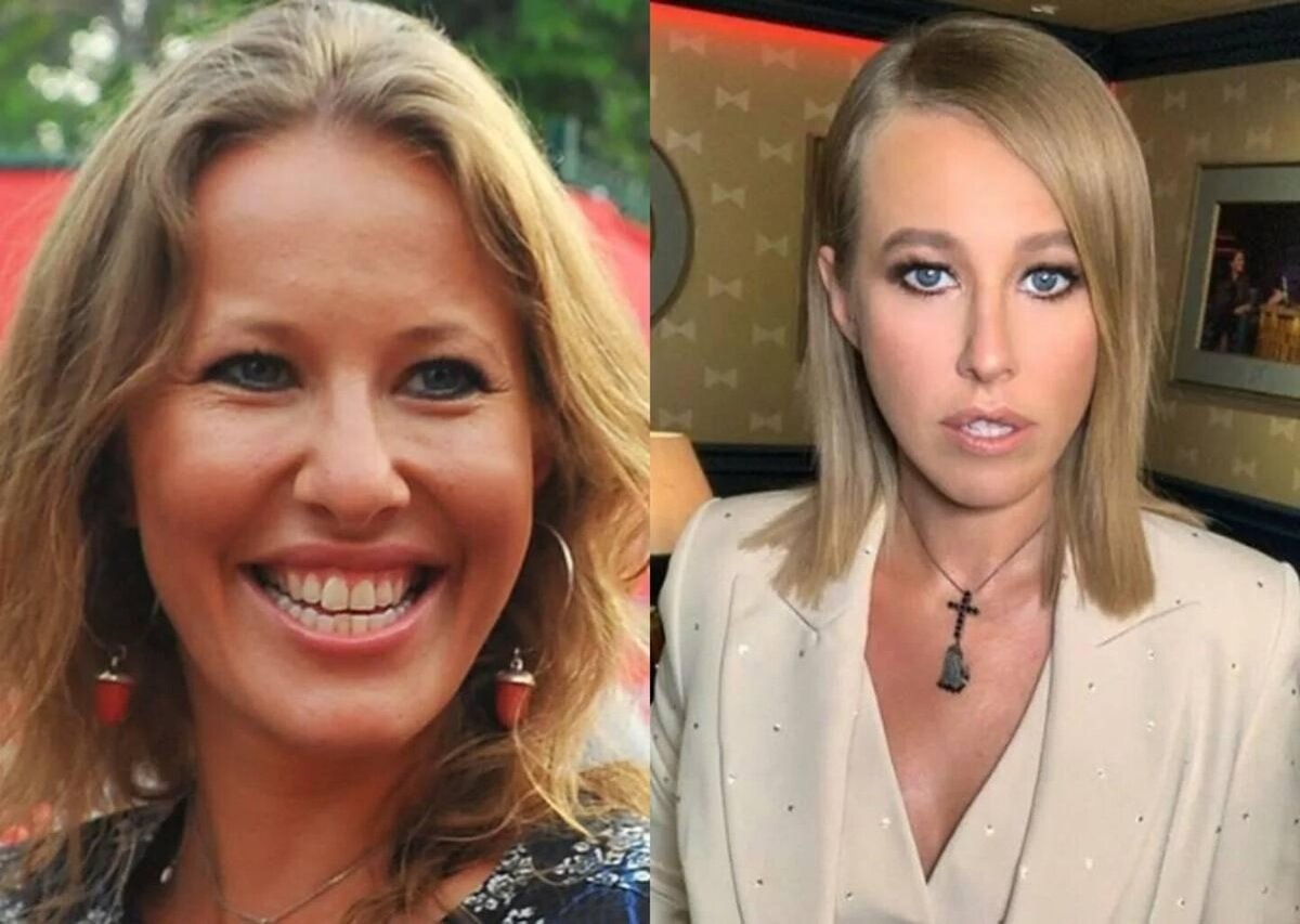 Пластика носа. Собчак пластика. Собчак сделала операцию. Собчак ринопластика. Собчак сделала операцию.