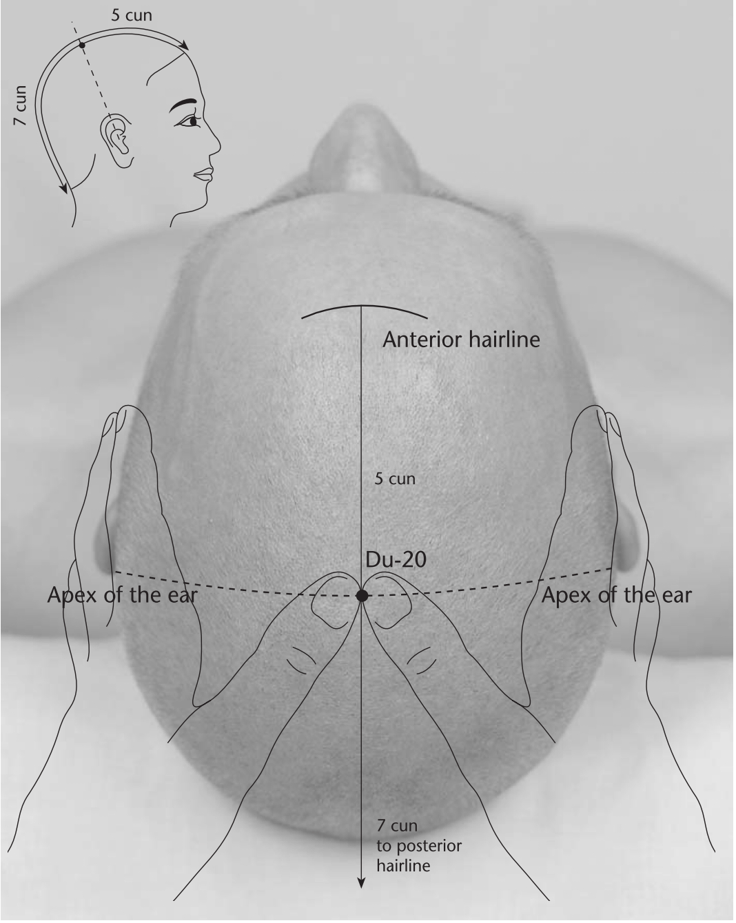 Расположение точки Бай Хуэй
