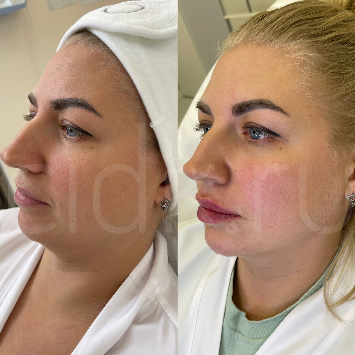 ПЕРЕЗАГРУЗКА КАТИ