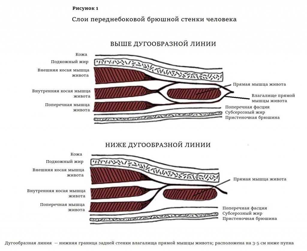 Переднебоковая стенка