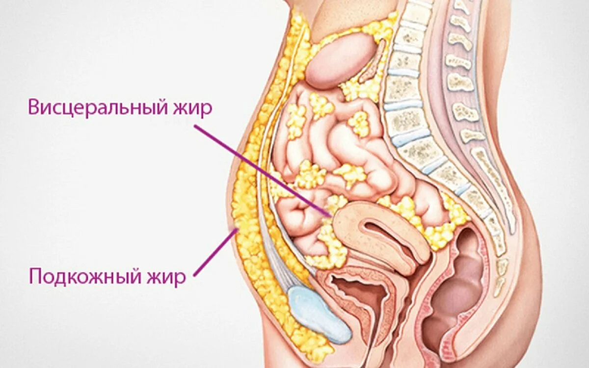 Жир и грязь. Висцеральный жир на животе у мужчин. Подкожный и висцеральный жир. Висцеральный жир в разрезе.