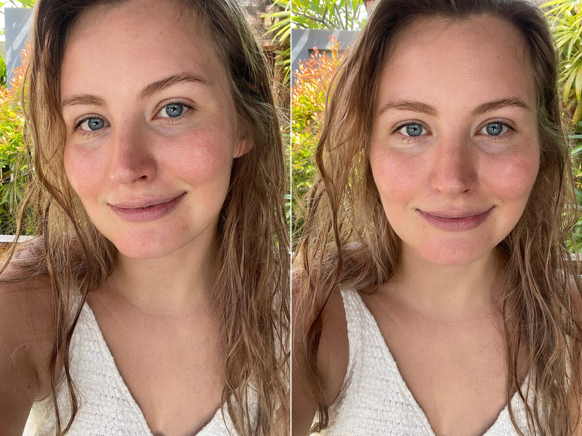 Так я выглядела до процедуры, без косметики и фильтров :)