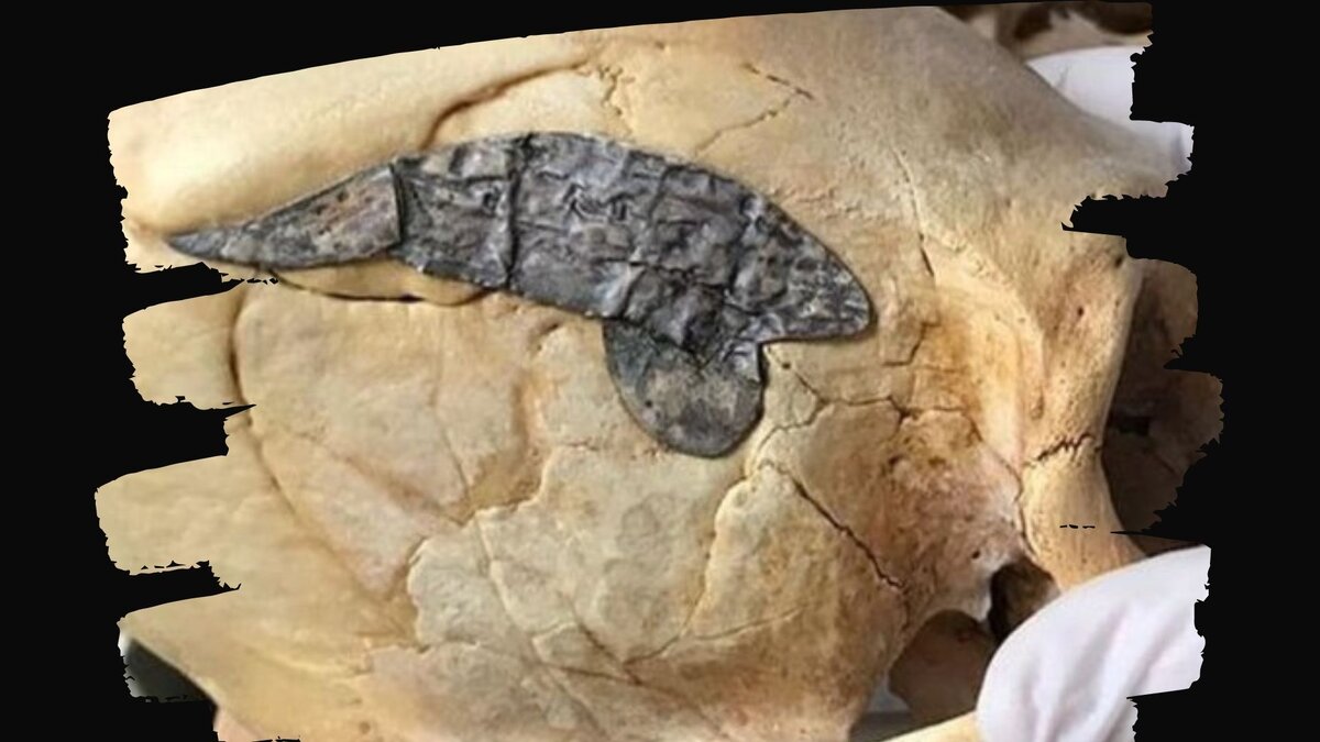 Видимо пациент выжил