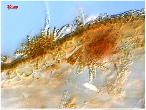 Фото микроскопии водорослей Streblonema corymbiferum. Растут на поверхности водоросли-хозяина Undaria pinnatifida.