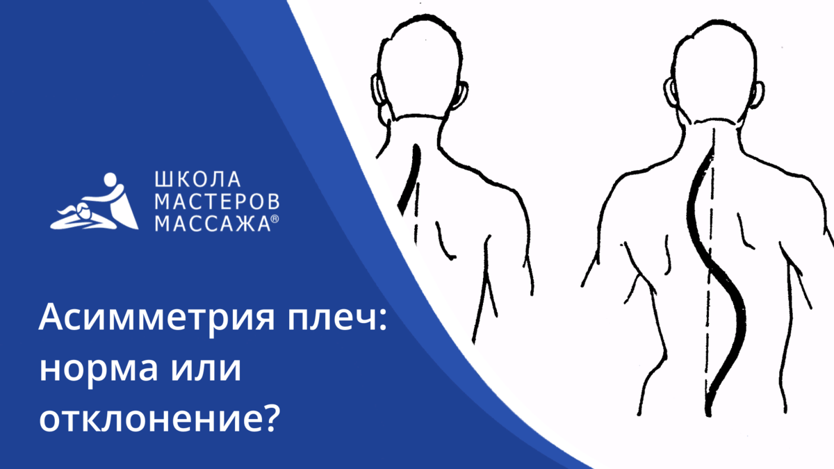 Асимметрия плеч: норма или отклонение? | Школа мастеров массажа | СПБ/МСК |  Дзен