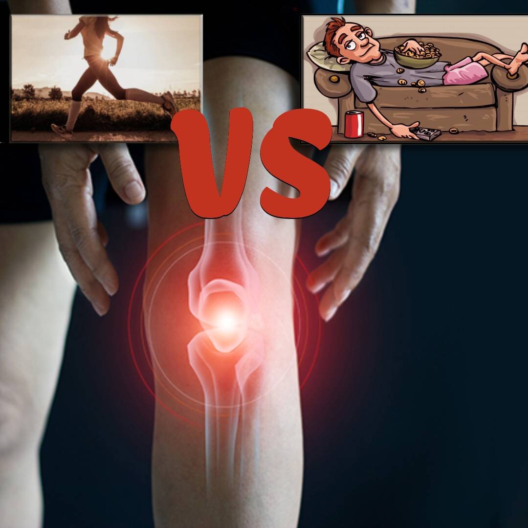 Артроз (гонартроз) коленного сустава