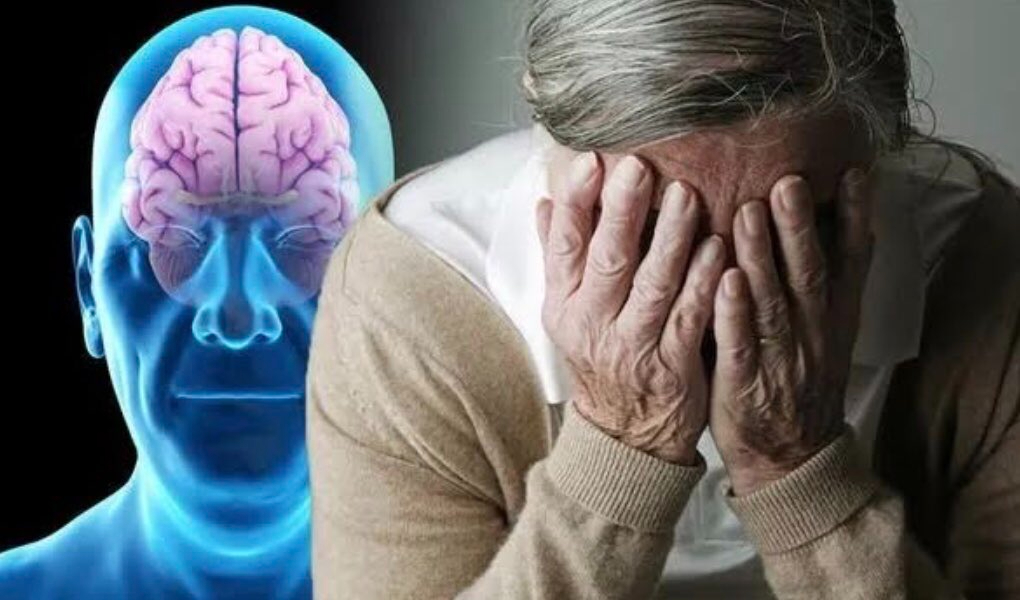 Деменция Альцгеймера. Мозг пожилых людей. Старческая память. Ухудшение памяти.