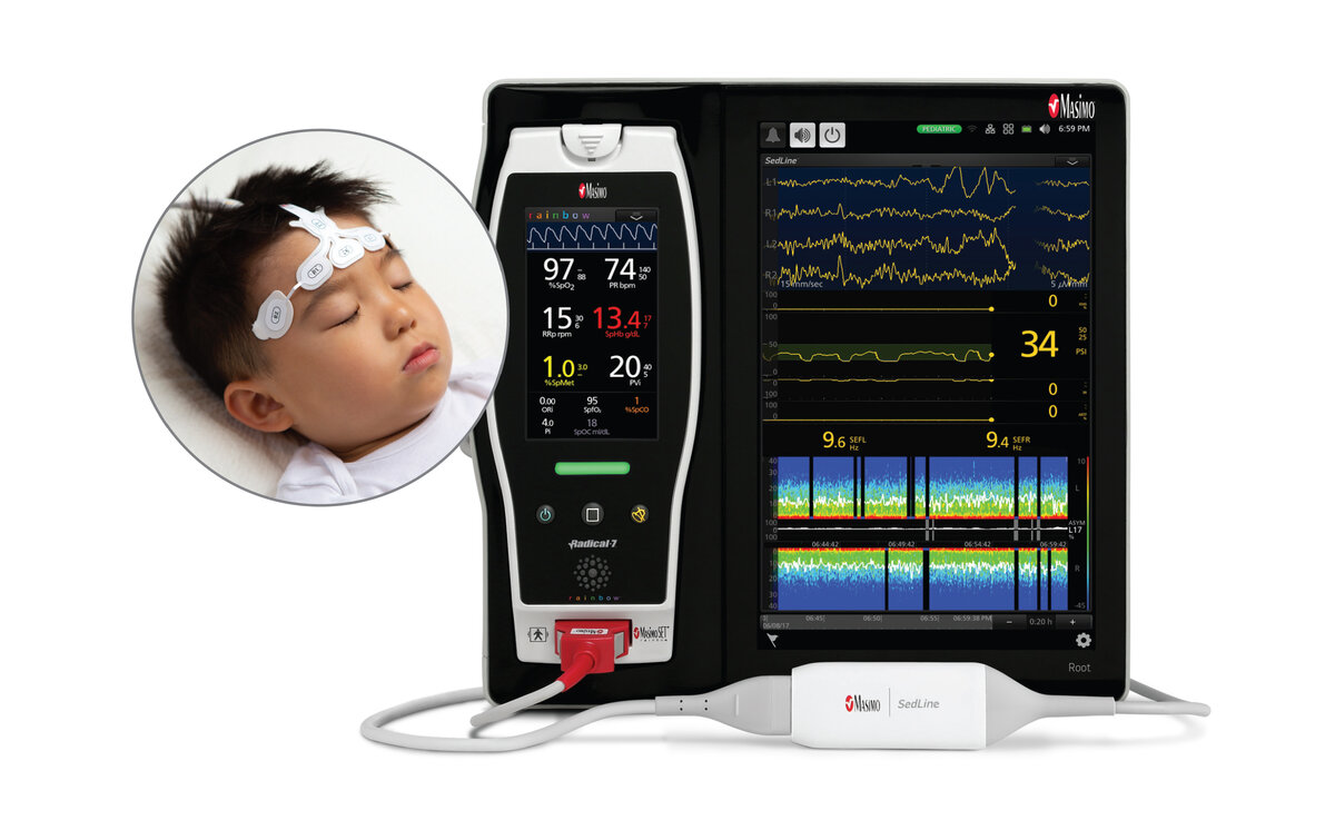 Иорданская компания Masimo известна как производитель технологий неинвазивного мониторинга состояния пациента, начиная с пульсоксиметра SET и заканчивая недавно сертифицированном в Европе Rainbow...-2