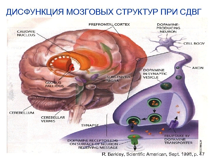 Нарушение функций мозга. Мозг ребенка с СДВГ. Мозг гиперактивного ребенка. Дисфункции мозговых структур. Синдромы нарушения внимания