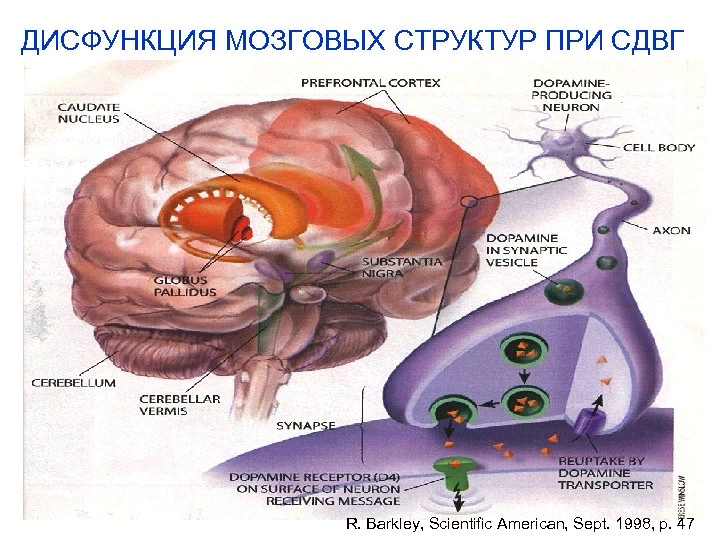 Дисфункция структур головного мозга это. Нарушение функций мозга. Функциональные нарушения головного мозга. Дисфункция мозговых структур что это. Патогенез СДВГ
