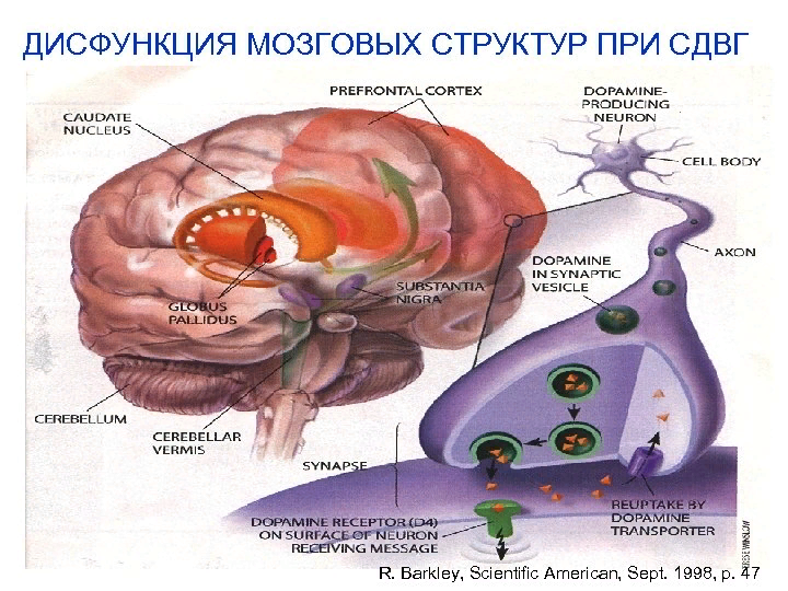 Нарушение функций мозга. Функциональные нарушения головного мозга. Мозг ребенка с СДВГ. Мозг гиперактивного ребенка.