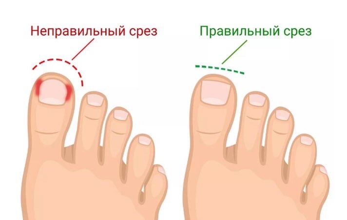 Красные ногти на ногах: идеи и стили